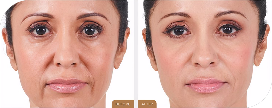 Before & After-img@1.2x (1)Edit